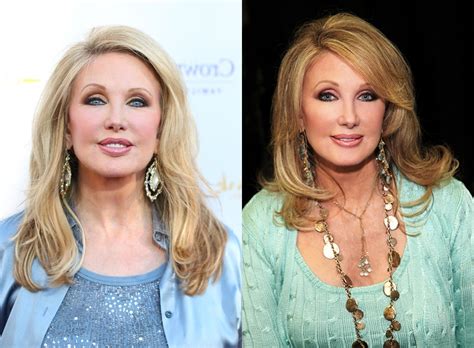 morgan fairchild tits|Morgan Fairchild Plastic Surgery Before and After Photos.